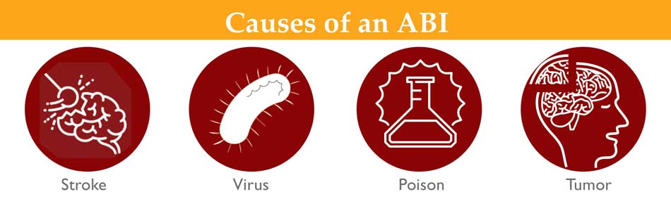 Causes of ABI